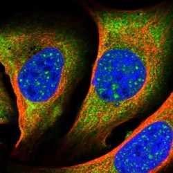 LIM Kinase 1 Antibody, Novus Biologicals:Antibodies:Primary Antibodies